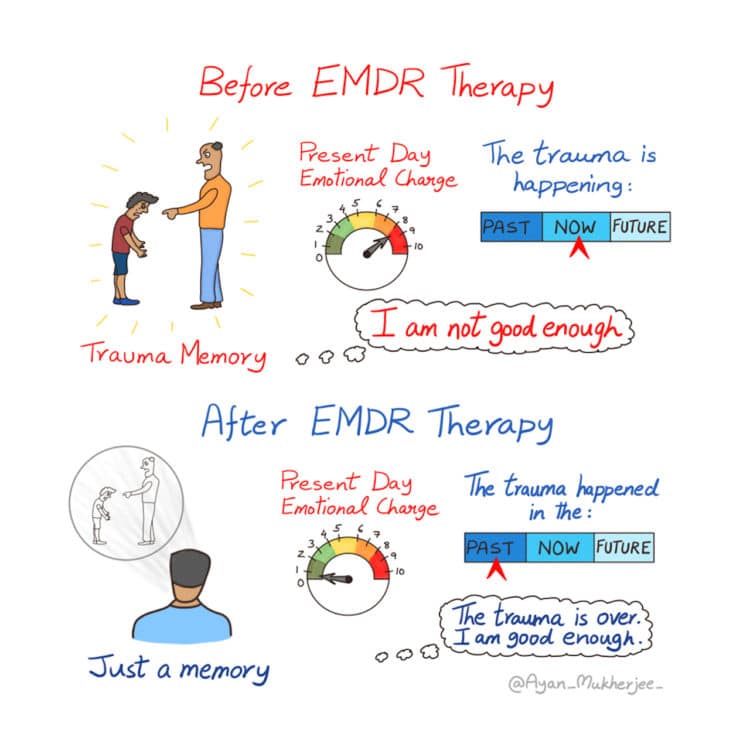 The Powerful Effect of EMDR Therapy to Treat Mental Health Conditions