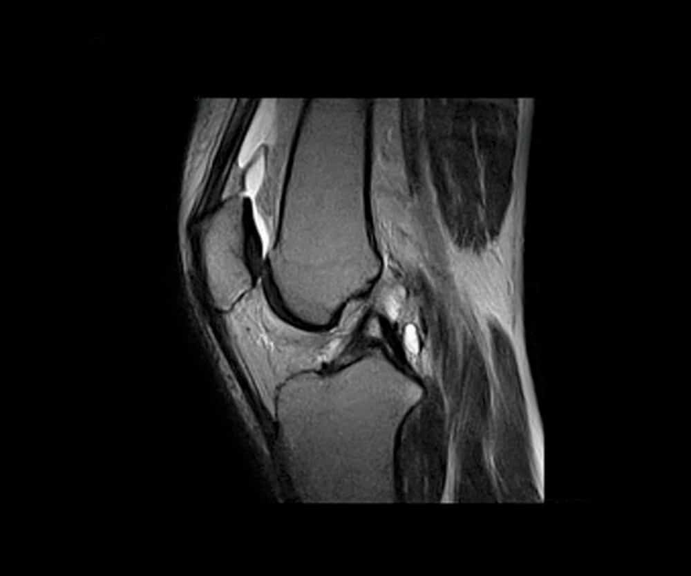 Knee. O-scan SMART. Courtesy of Esaote.