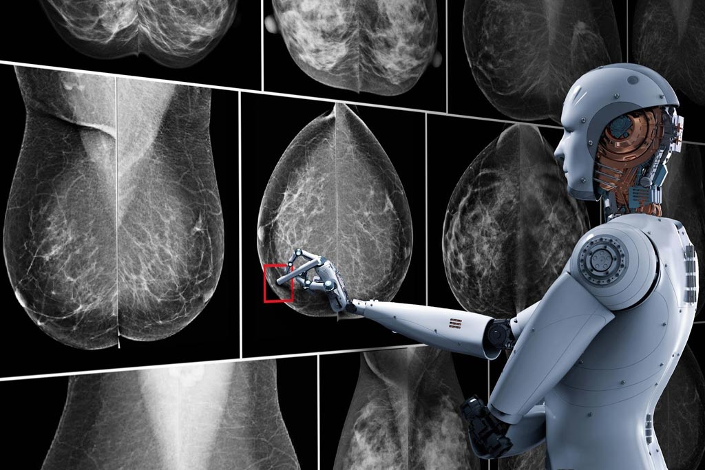 AI breast cancer radiologists