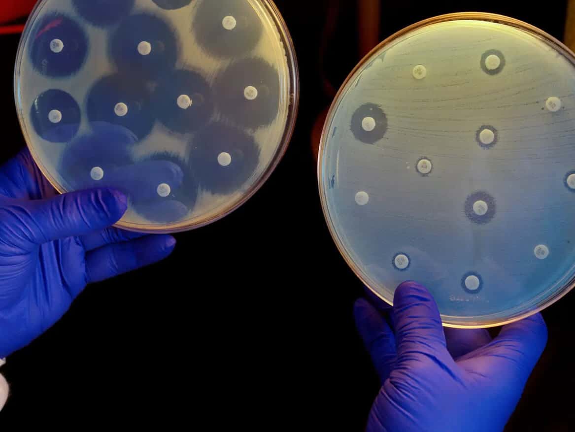 A researcher holds up two culture plates growing bacteria in the presence of discs containing various antibiotics. The one on the right has a strain that is resistant to all antibiotics tested. (Credit: Science History Images/Alamy)