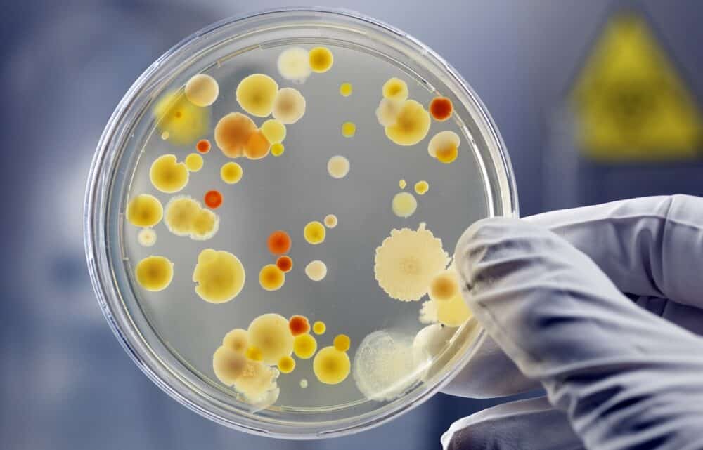 Image Artificial Intelligence vs Antibiotic Resistance
