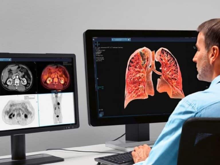 [MEDICA] Three Promising Trends in Medical Imaging - MedicalExpo e-Magazine