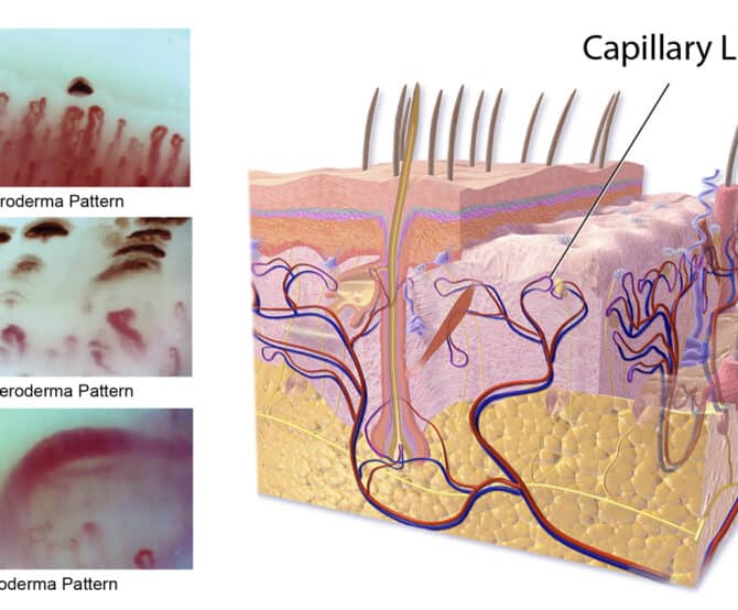 Image Inspectis Expand Possibilities of Capillaroscopy Examination