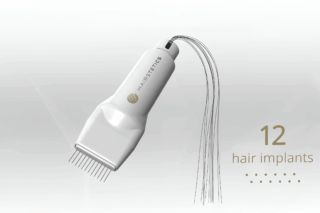 Image Hairstetics: A Cutting-Edge, Non-Surgical Femtech Solution for Hair Loss