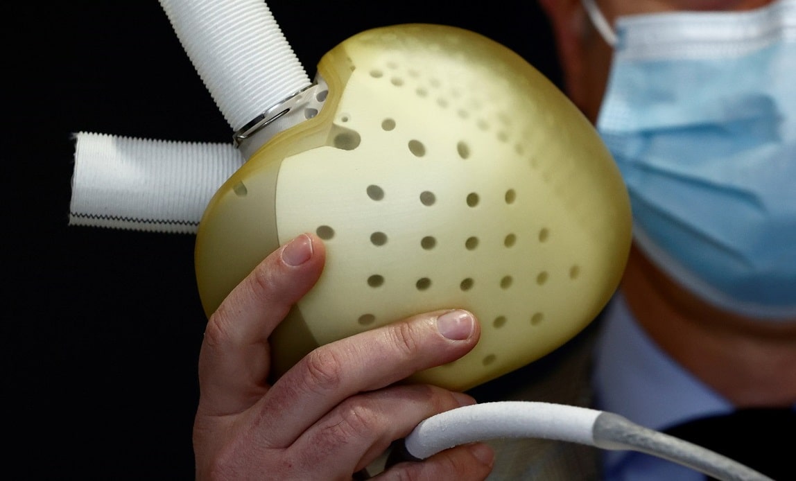 Carmat's Chief Executive Officer, Stephane Piat, poses holding an artificial heart near Paris in January 2021. (Credit: REUTERS/Christian Hartmann)