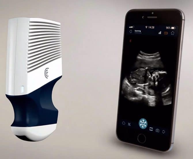 Image Meet Clarius, Pocket-Sized Wireless Scanner