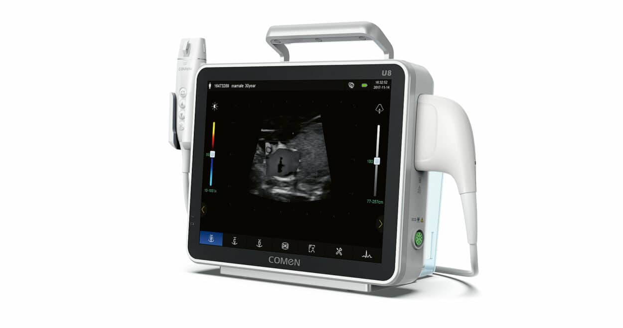 U8 ECG Doppler Ultrasound System. (Credit: Shenzhen Comen)