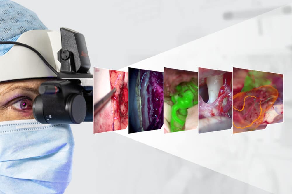 With MyVeo you experience a smooth workflow without having to look at multiple screens. (Credit: Leica Microsystems)