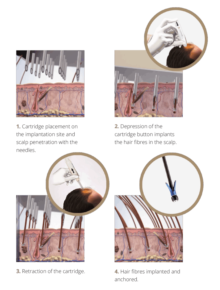 Courtesy of Hairstetics