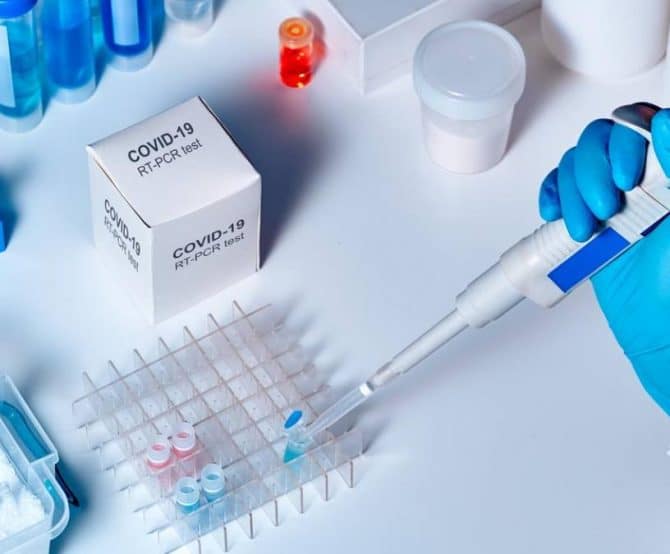 Image Brazilian Hospital Creates the First Genetic Test for SARS-CoV-2