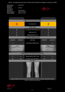 In a few years from now, there won’t be any image study seen by radiologists which has not been pre-analyzed by an AI algorithm first. (Credit: IB Lab)