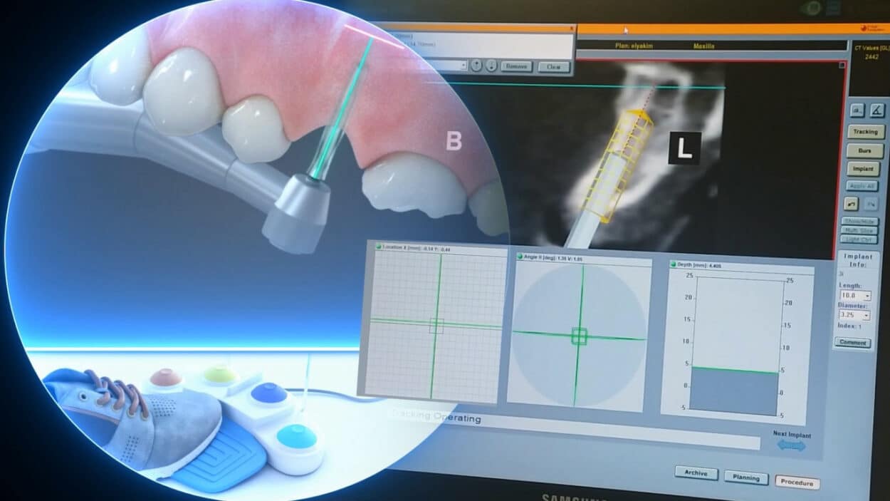 Image Navigation showcased its image-guided implant dentistry system, the IGI 2.0. (Credit: Image Navigation)