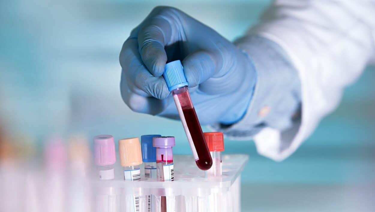 "With liquid biopsies, we look at the markers in the blood. To do this, we do a blood test and we try to see if we can find tumor cells in the blood to predict if there is a cancer or not." (Credit: Adobe Stock)