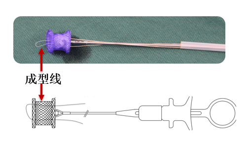 The MemoSorb (Credit : Lepu Medical)