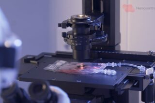 Image Brazil Delivers Latin America’s First Homegrown CAR-T Cancer Therapy