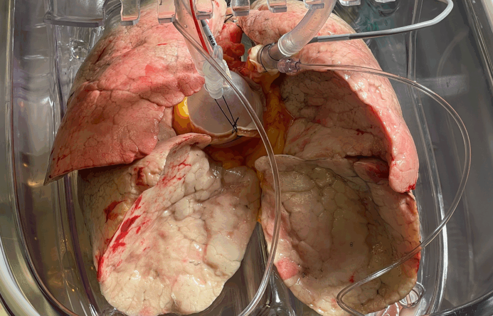 Image Targa Biomedical: The Quebec Startup Revolutionizing Organ Rescue and Cell Therapies