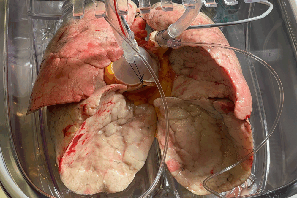 Targa Biomedical: The Quebec Startup Revolutionizing Organ Rescue and Cell Therapies