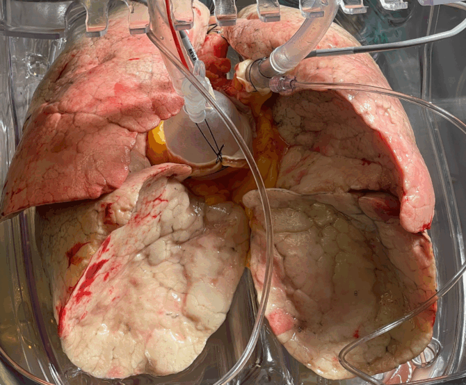 Image Targa Biomedical: The Quebec Startup Revolutionizing Organ Rescue and Cell Therapies