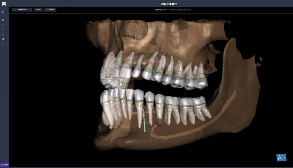 AI X-Ray Technology: How Dentists Catch Problems You Cannot See