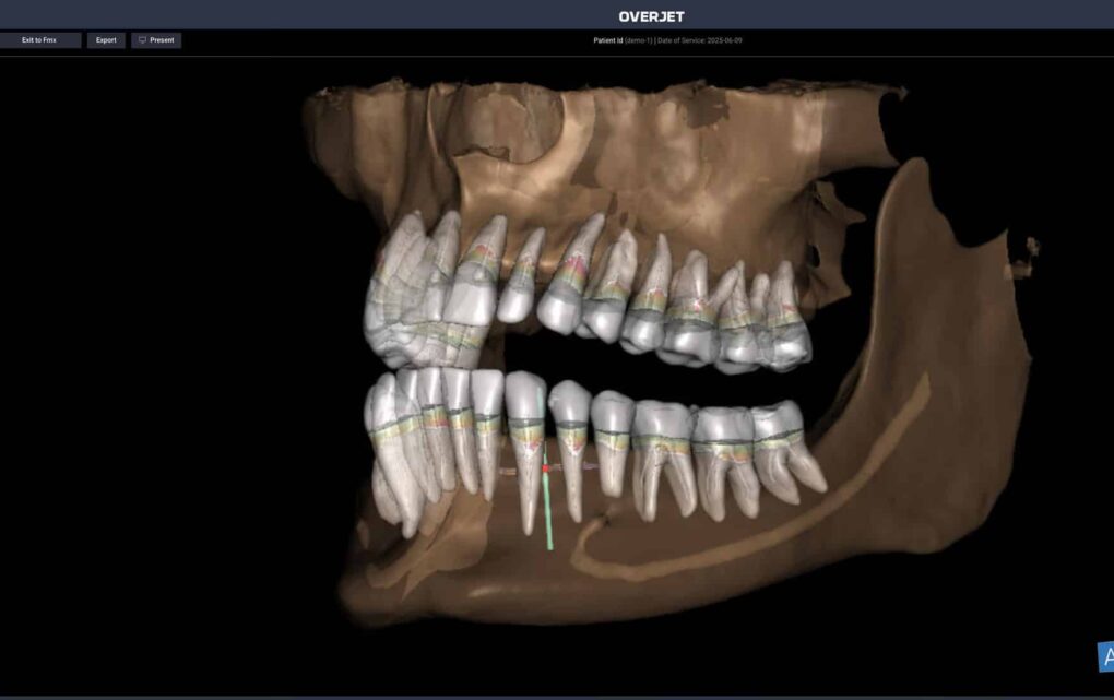 Image AI X-Ray Technology: How Dentists Catch Problems You Cannot See
