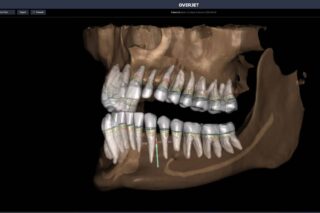 Image AI X-Ray Technology: How Dentists Catch Problems You Cannot See