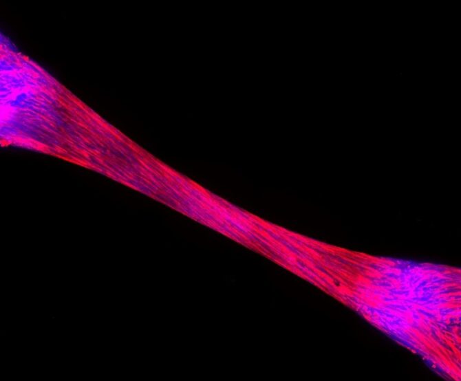 Image ProFuse Technology: From Cultivating Meat to Drug Discovery for Muscle Loss