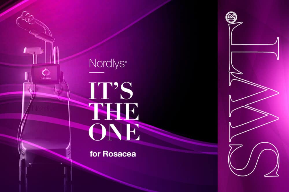 Nordlys® Advances in Rosacea: Assessing SWT® Narrowband IPL for Vascular Cases