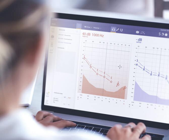 Image The Benefits of PC-based Audiometry
