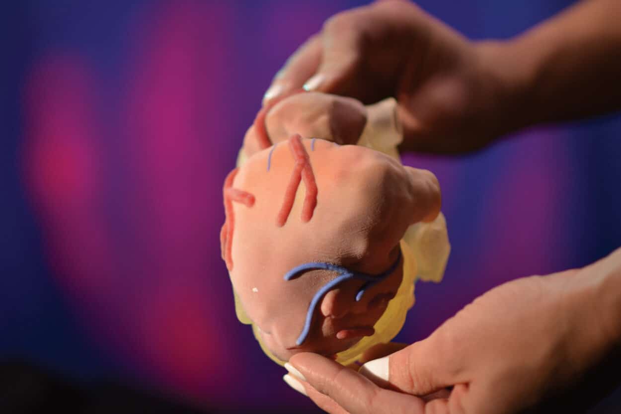 Stratasys' digital anatomy 3D printer uses novel biomechanical materials. (Credit: Stratasys)