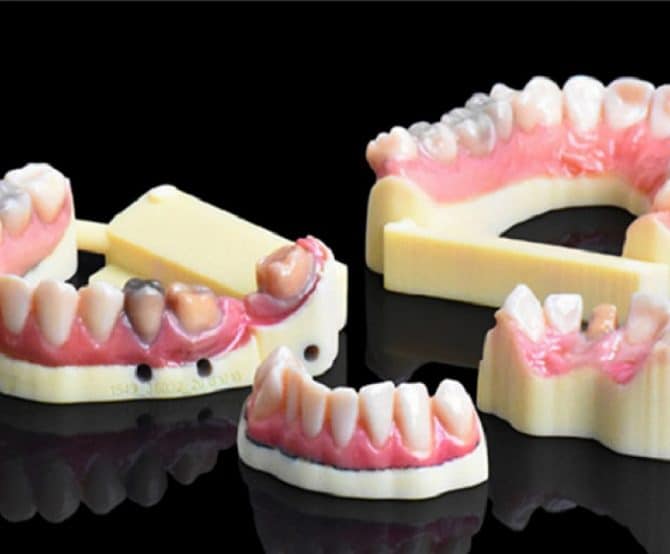 Image IDS. Stratasys’ New 3D Dental Printer