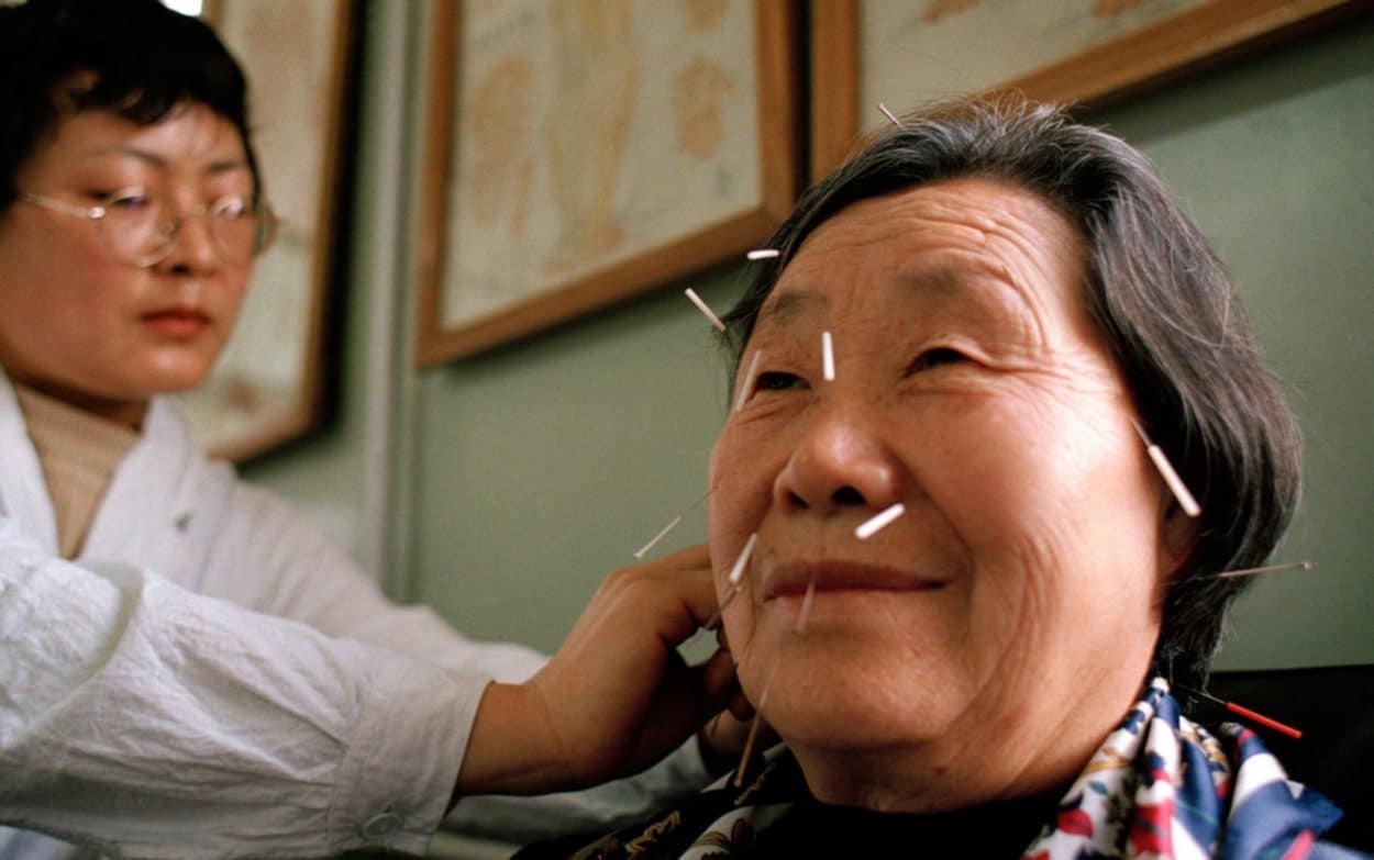 Facial acupuncture is administered to a patient in Beijing. (Credit: Justin Jin/Panos)