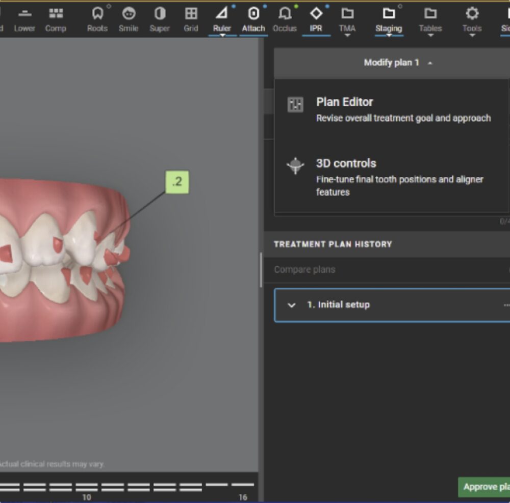 ClicCheck Software. Courtesy of Align Technology.