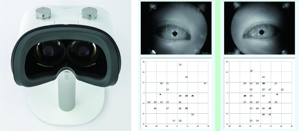 Crewt Medical Systems' wearable visual testing device "IMOvifa" for glaucoma and other eye problems. (Credit: CREWT Medical Systems)