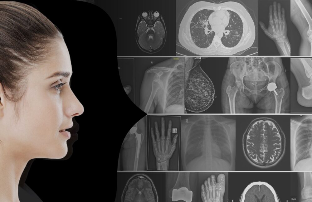 AI-powered imaging agent. Courtesy of Deemea.