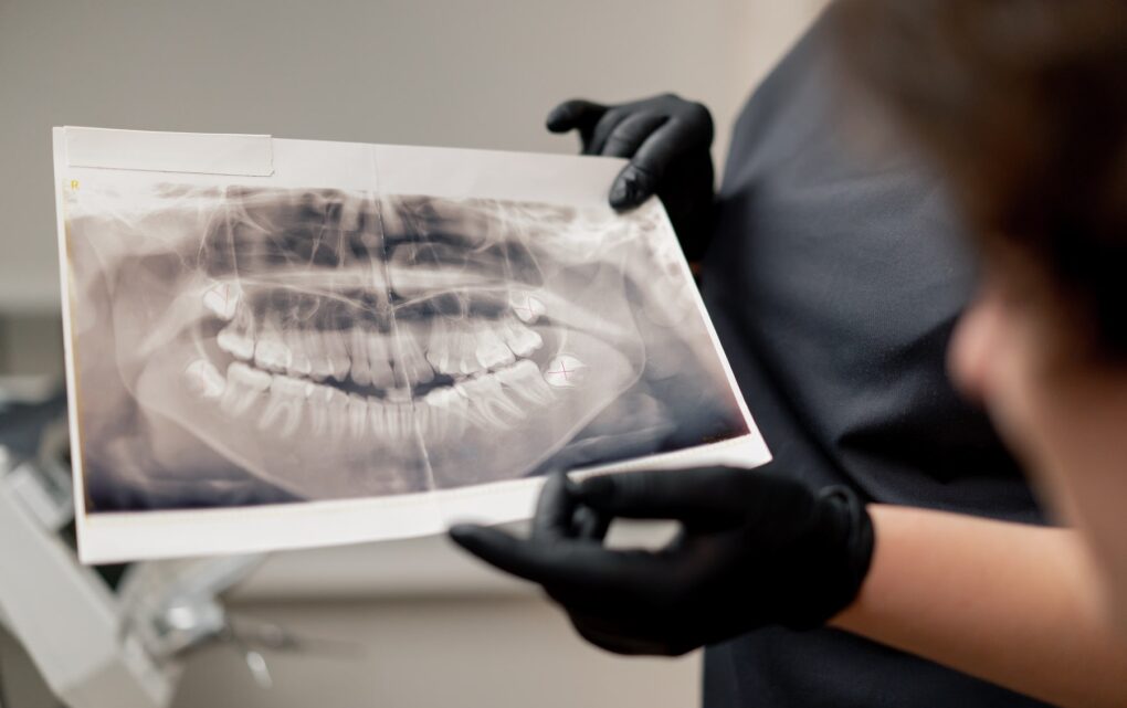 Image [Dental] Inside the Straumann EXACT™ Digital Pilot with ClearChoice