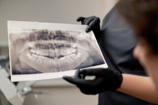 Image [Dental] Inside the Straumann EXACT™ Digital Pilot with ClearChoice