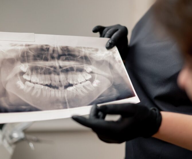 Image [Dental] Inside the Straumann EXACT™ Digital Pilot with ClearChoice