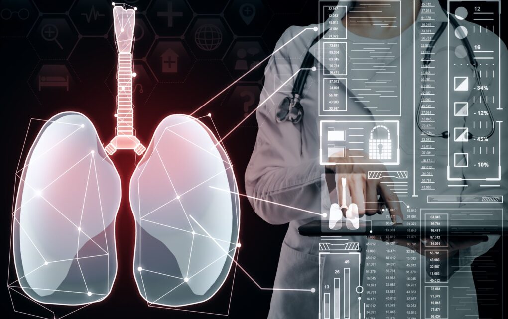 Image Rewriting the Lung Map: How AI-Driven Imaging Is Transforming Emphysema Diagnosis