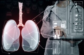 Image Rewriting the Lung Map: How AI-Driven Imaging Is Transforming Emphysema Diagnosis