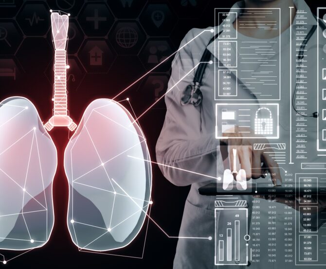 Image Rewriting the Lung Map: How AI-Driven Imaging Is Transforming Emphysema Diagnosis