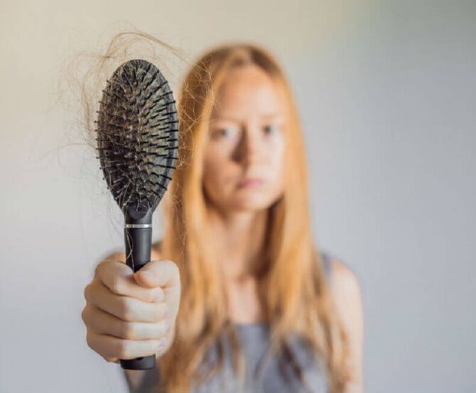Image Stem Cells From Stomach Fat Used to Help With Hair Regrowth 