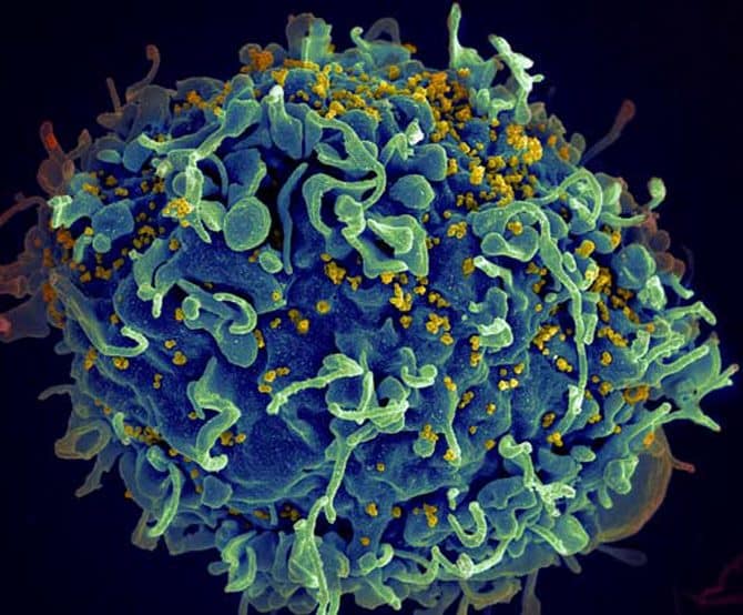 Image HIV Tests from Smart Vending Machines