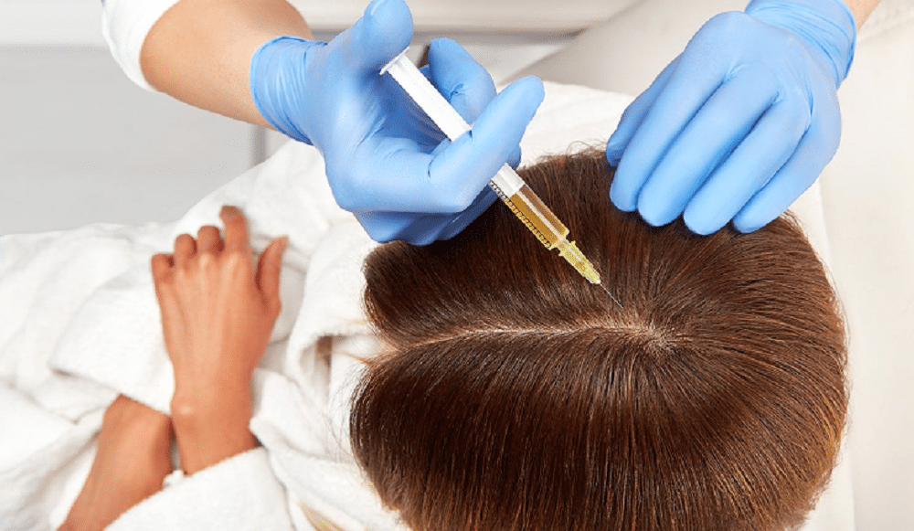 PRP is also being tested as a possible treatment for hair loss. (Credit: CSHP Paris)