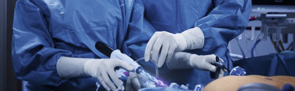 Thunderbeat II for Hemostatic Cutting and Vessel Sealing. Courtesy of Olympus.