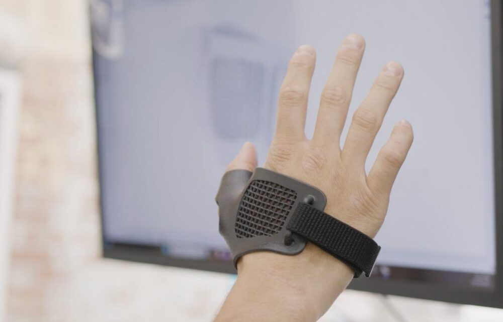 Image From Legacy to Local: How mign is Transforming Orthopaedic Bracing with Carbon 3D Printing