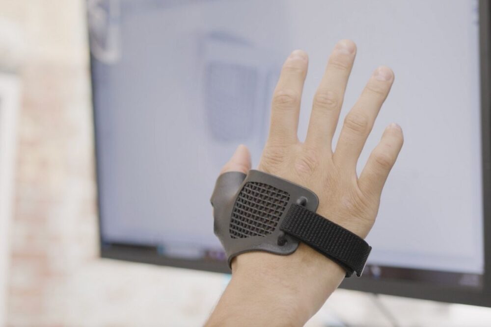 From Legacy to Local: How mign is Transforming Orthopaedic Bracing with Carbon 3D Printing