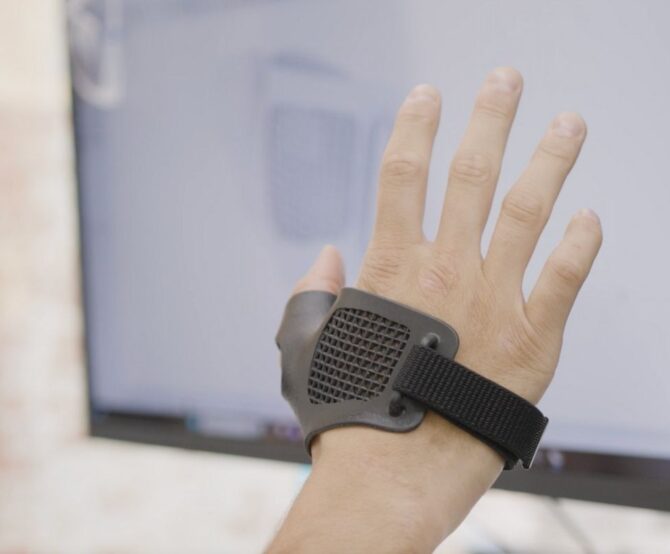 Image From Legacy to Local: How mign is Transforming Orthopaedic Bracing with Carbon 3D Printing