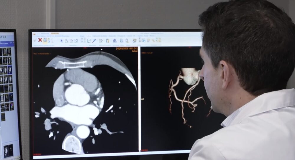 The MRI and CT service at Nuestra Señora del Rosario University Hospital in Madrid has become the first clinical center worldwide to install the Verida Spectral CT system developed by Philips.
