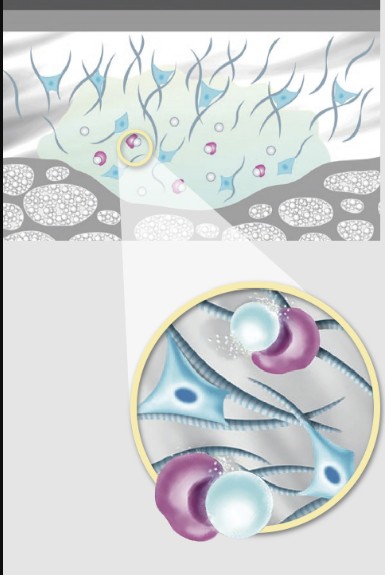 CaHA is the key. Calcium hydroxylapatite, or CaHA, is what makes Radiesse unique as a dermal filler treatment. Radiesse is composed of CaHA suspended in an aqueous gel carrier. Learn more at Radiesse.