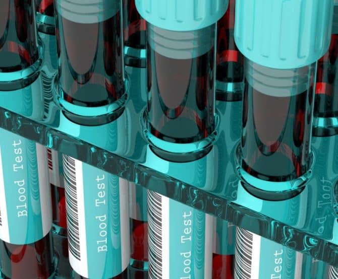 Image Blood Testing is Undergoing a Revolution